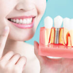 Top 5 Benefits of Invisible Braces That Make Them a Perfect Dental Solution to Straighten Your Teeth