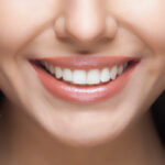 Do You Need a Smile Makeover