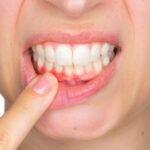 A Healthy Smile: Preventing Tooth Decay and Gum Disease