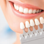Dental veneers what are they made up of?