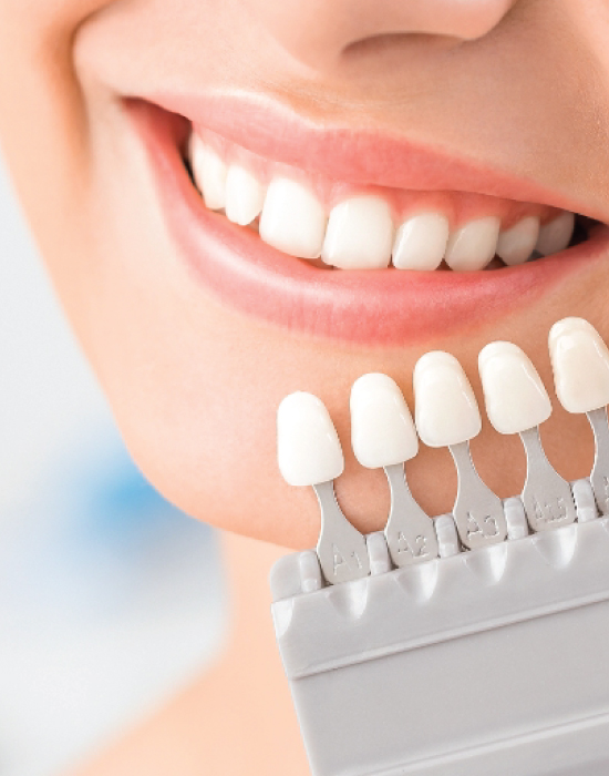 Dental veneers what are they made up of?